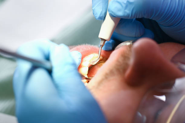 Best Urgent Tooth Repair  in Elmer, NJ