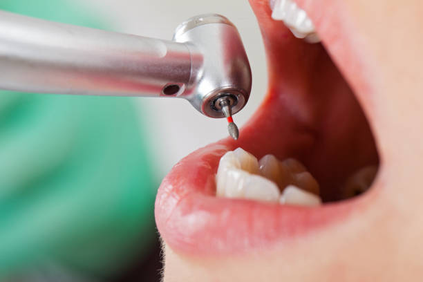 Best Tooth Infection Emergency Dentist  in Elmer, NJ